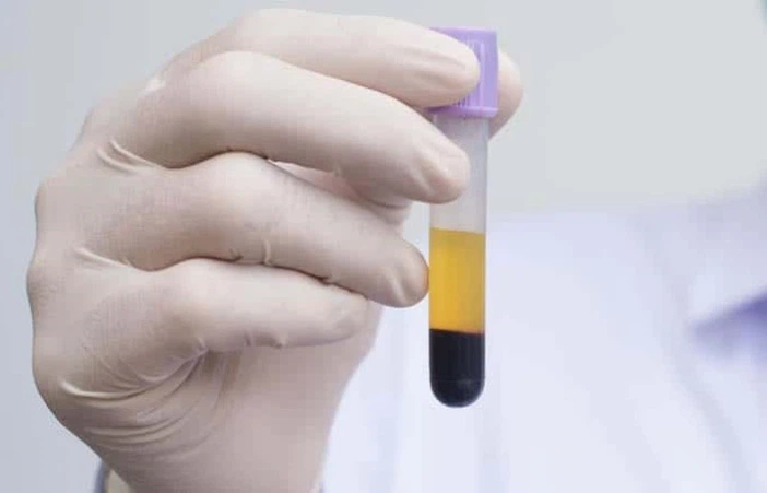 GS-441524 Serum Natural Chemistry Profile | Shaanxi BLOOM Tech Co., Ltd GS-441524 Serum Natural Chemistry Profile | Shaanxi BLOOM Tech Co., Ltd