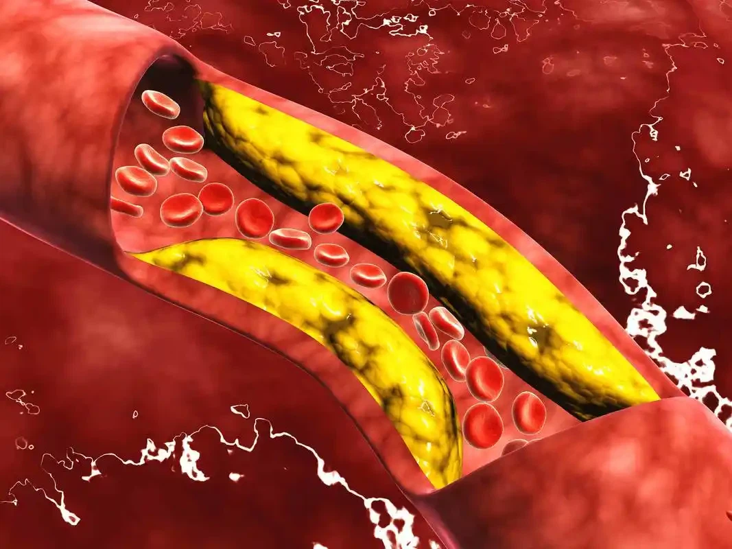 Bioglutide NA-931 Benefits | Shaanxi BLOOM Tech Co., Ltd Bioglutide NA-931 Benefits | Shaanxi BLOOM Tech Co., Ltd