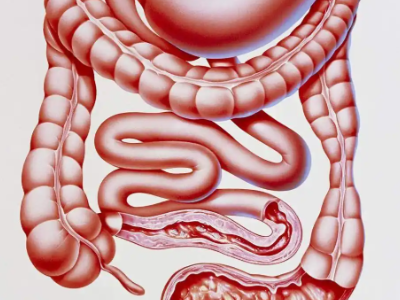 Bioglutide 250mcg | Shaanxi BLOOM Tech Co., Ltd Bioglutide 250mcg | Shaanxi BLOOM Tech Co., Ltd