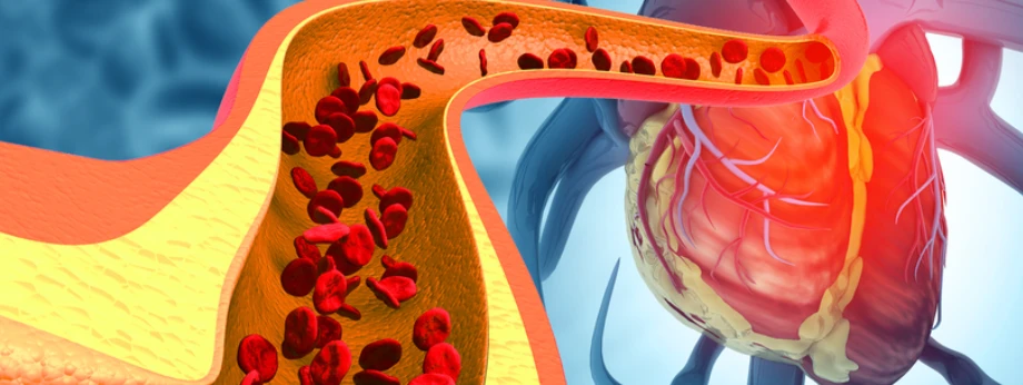 Bioglutide NA-931 Evidence | Shaanxi BLOOM Tech Co., Ltd Bioglutide NA-931 Evidence | Shaanxi BLOOM Tech Co., Ltd