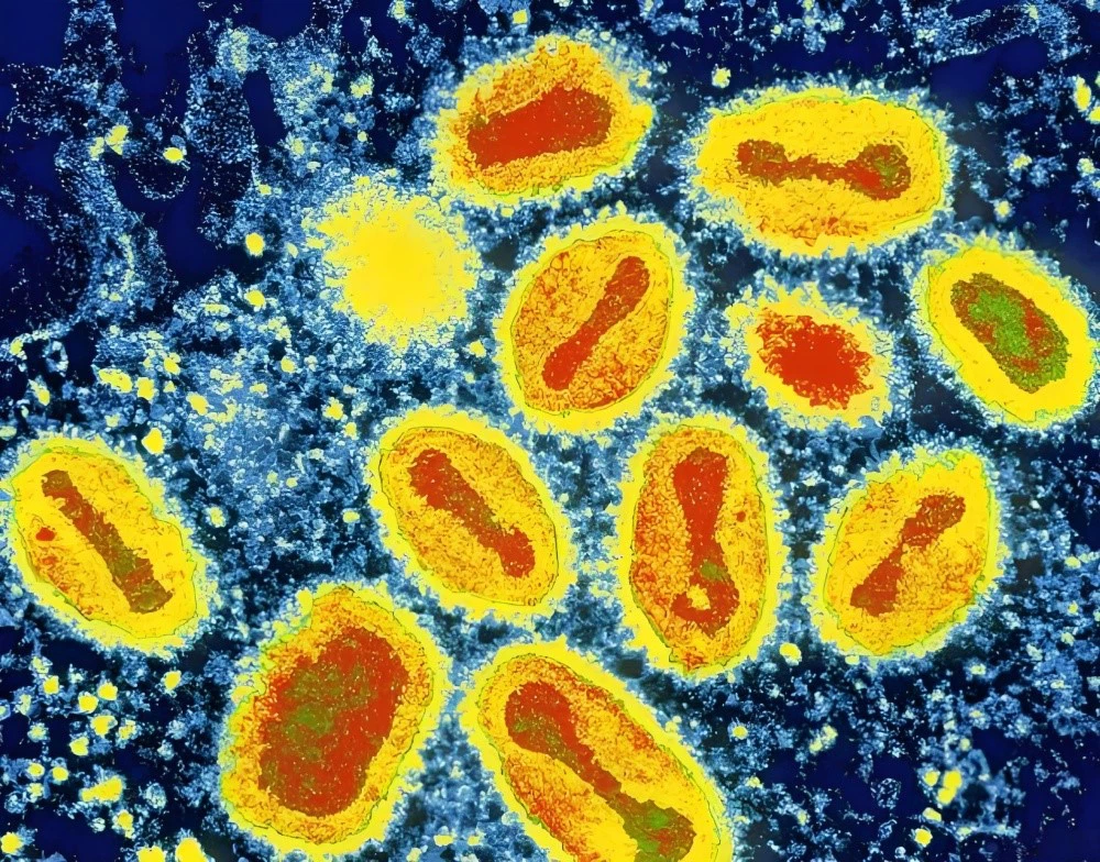 Metronidazole Topical Cream 75% use| Shaanxi BLOOM Tech Co., Ltd Metronidazole Topical Cream 75% use| Shaanxi BLOOM Tech Co., Ltd