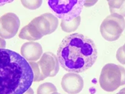 Plecanatide Cost | Shaanxi BLOOM Tech Co., Ltd Plecanatide Cost | Shaanxi BLOOM Tech Co., Ltd